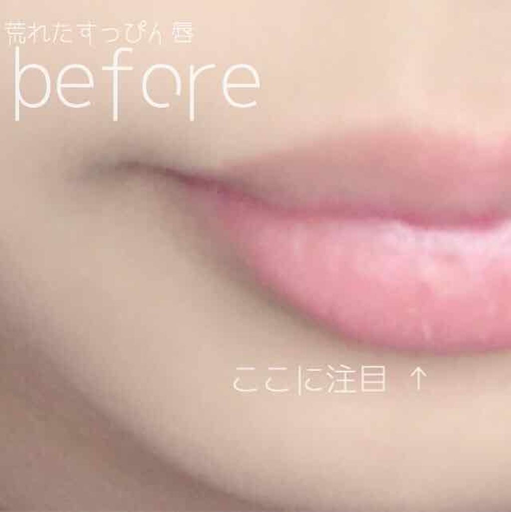 キスフル リップケア/ETUDE/リップグロスを使ったクチコミ（3枚目）