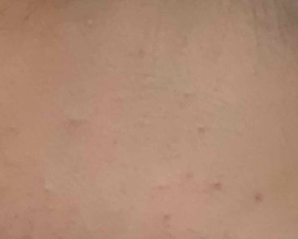 明色美顔水 薬用化粧水/美顔/化粧水を使ったクチコミ(2枚目)