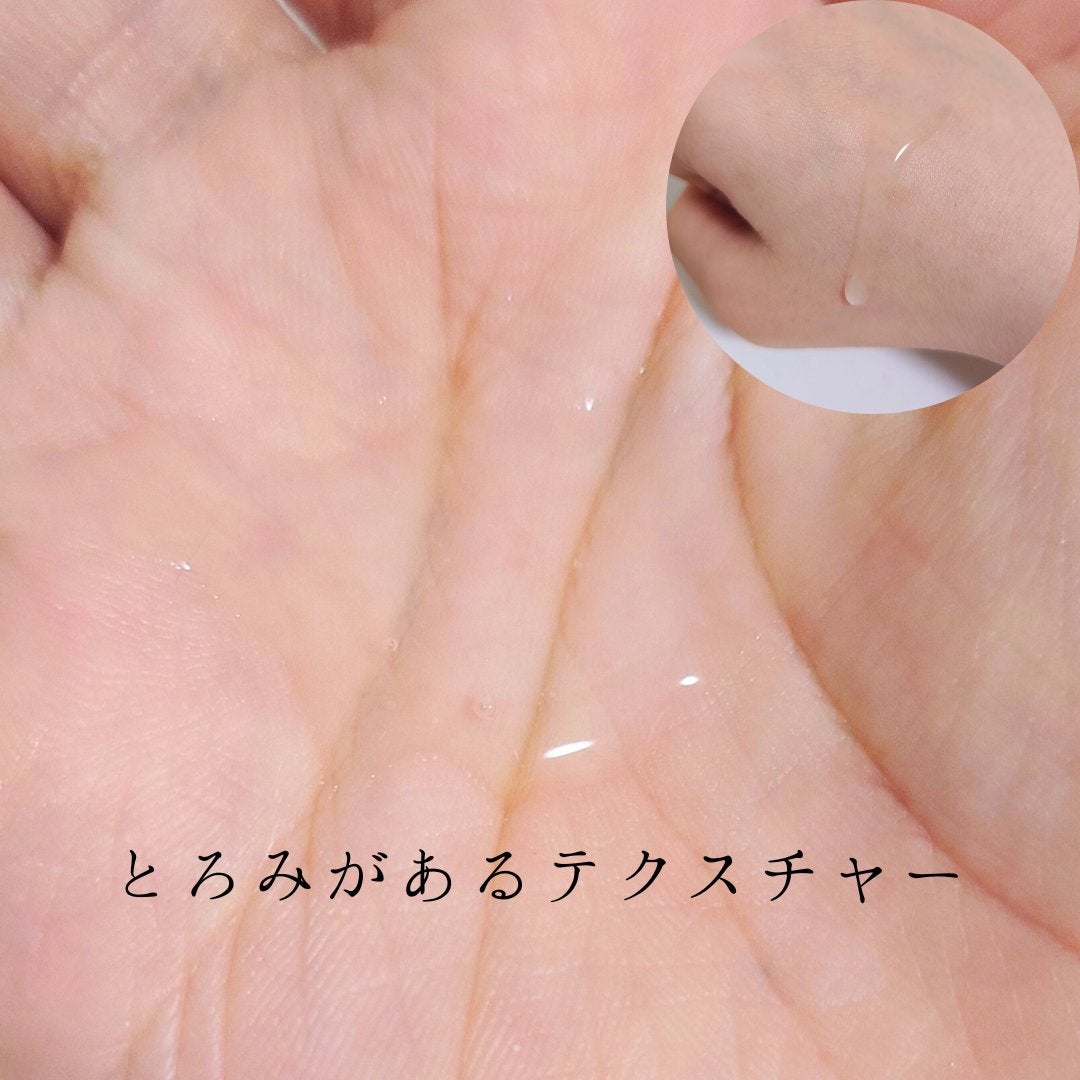 アクアヒアルロニックエッセンス/ロベクチン/化粧水を使ったクチコミ(2枚目)