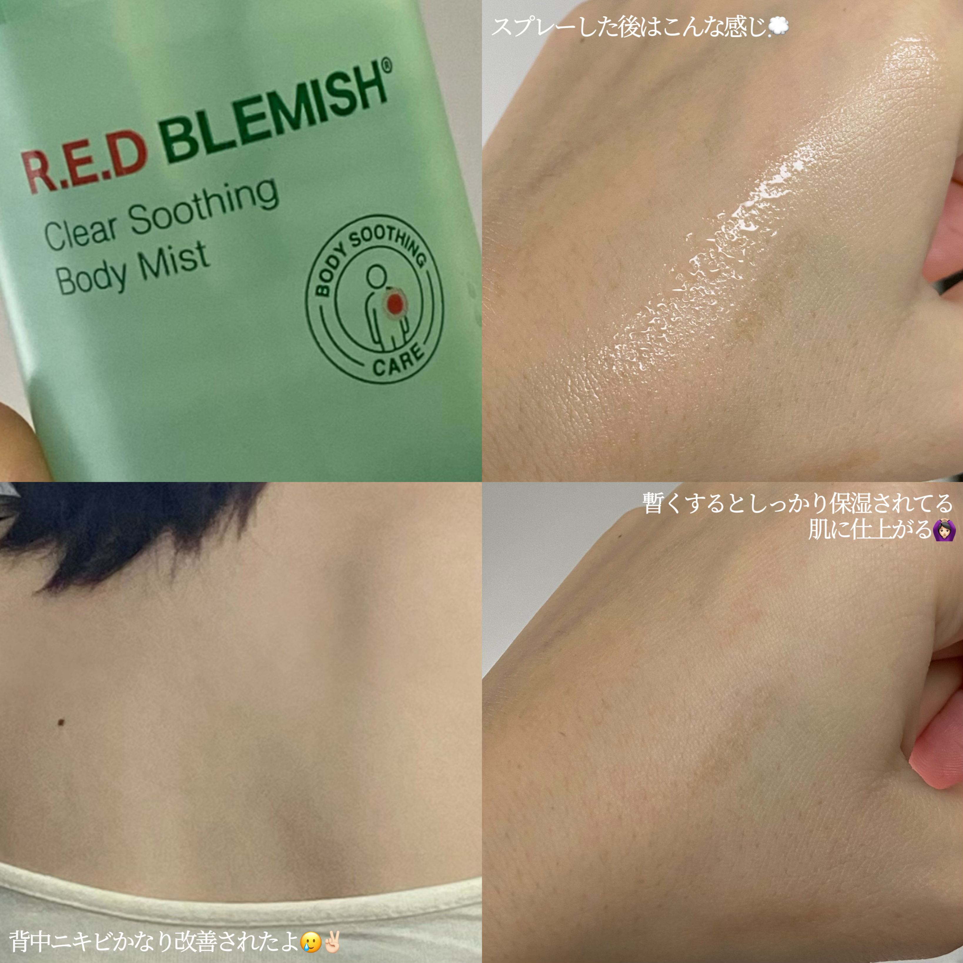 レッドブレミッシュスージングボディウォッシュ/Dr.G/ボディソープを使ったクチコミ（2枚目）