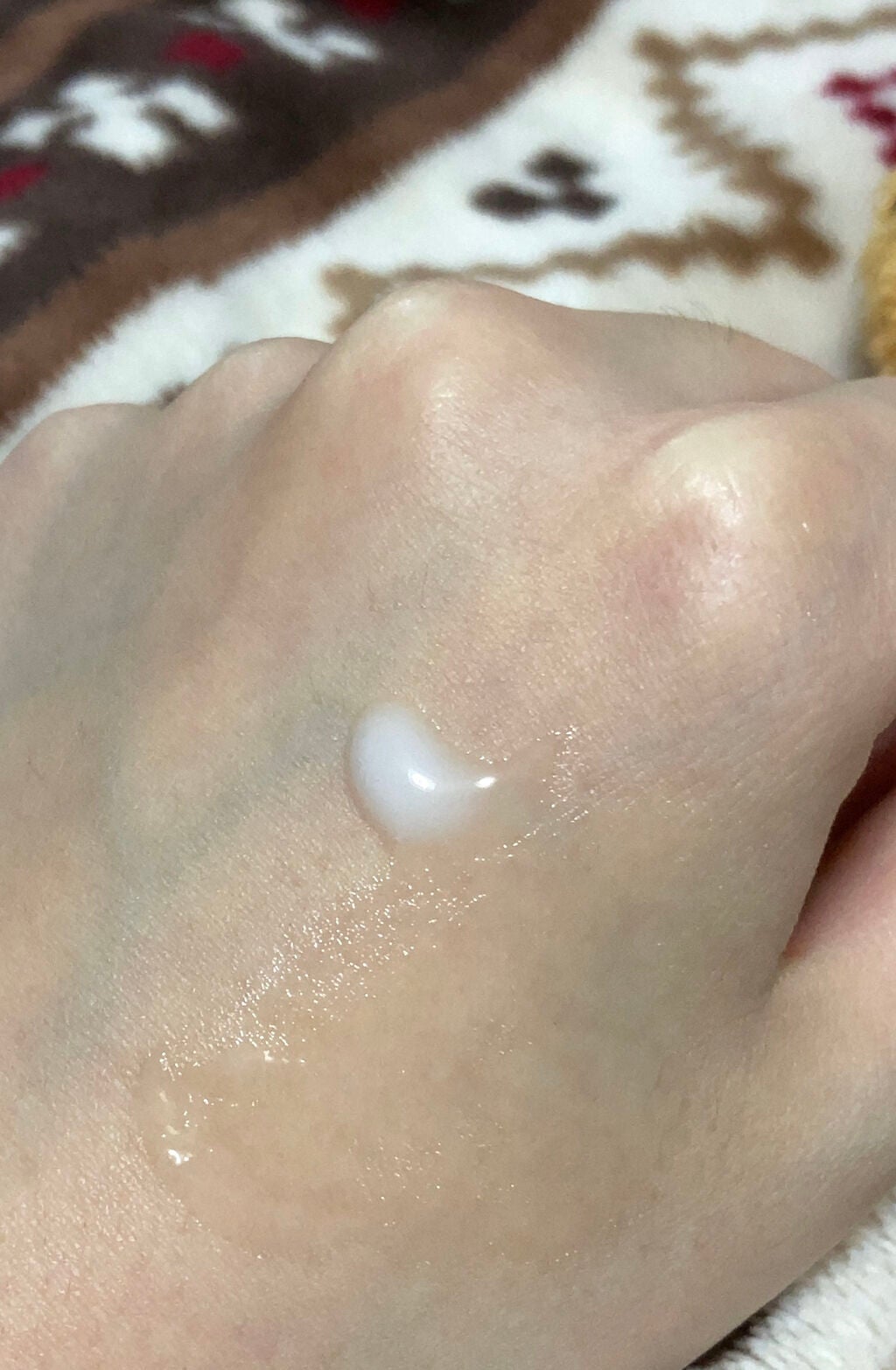 バランスケア ローション MB/d プログラム/化粧水を使ったクチコミ(4枚目)