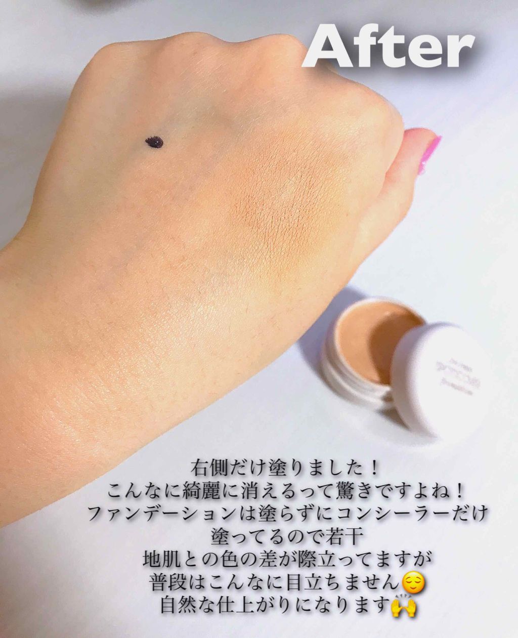 スポッツカバー ファウンデイション/SHISEIDO/クリームコンシーラーを使ったクチコミ(3枚目)