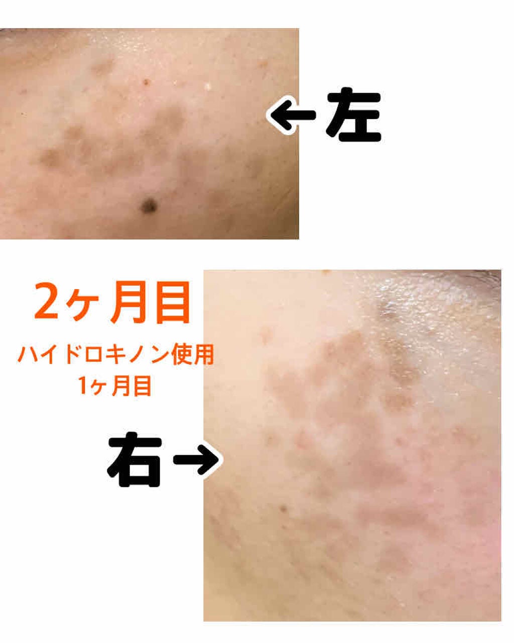 ナノHQクリーム/PLUSRESTORE/フェイスクリームを使ったクチコミ(2枚目)