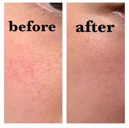 お米のマスク/毛穴撫子/シートマスク・パックを使ったクチコミ(1枚目)