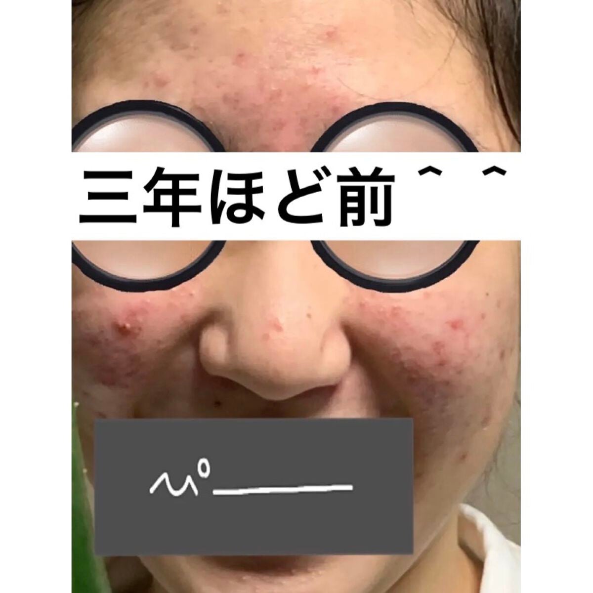 潤浸保湿 乳液/キュレル/乳液を使ったクチコミ(4枚目)