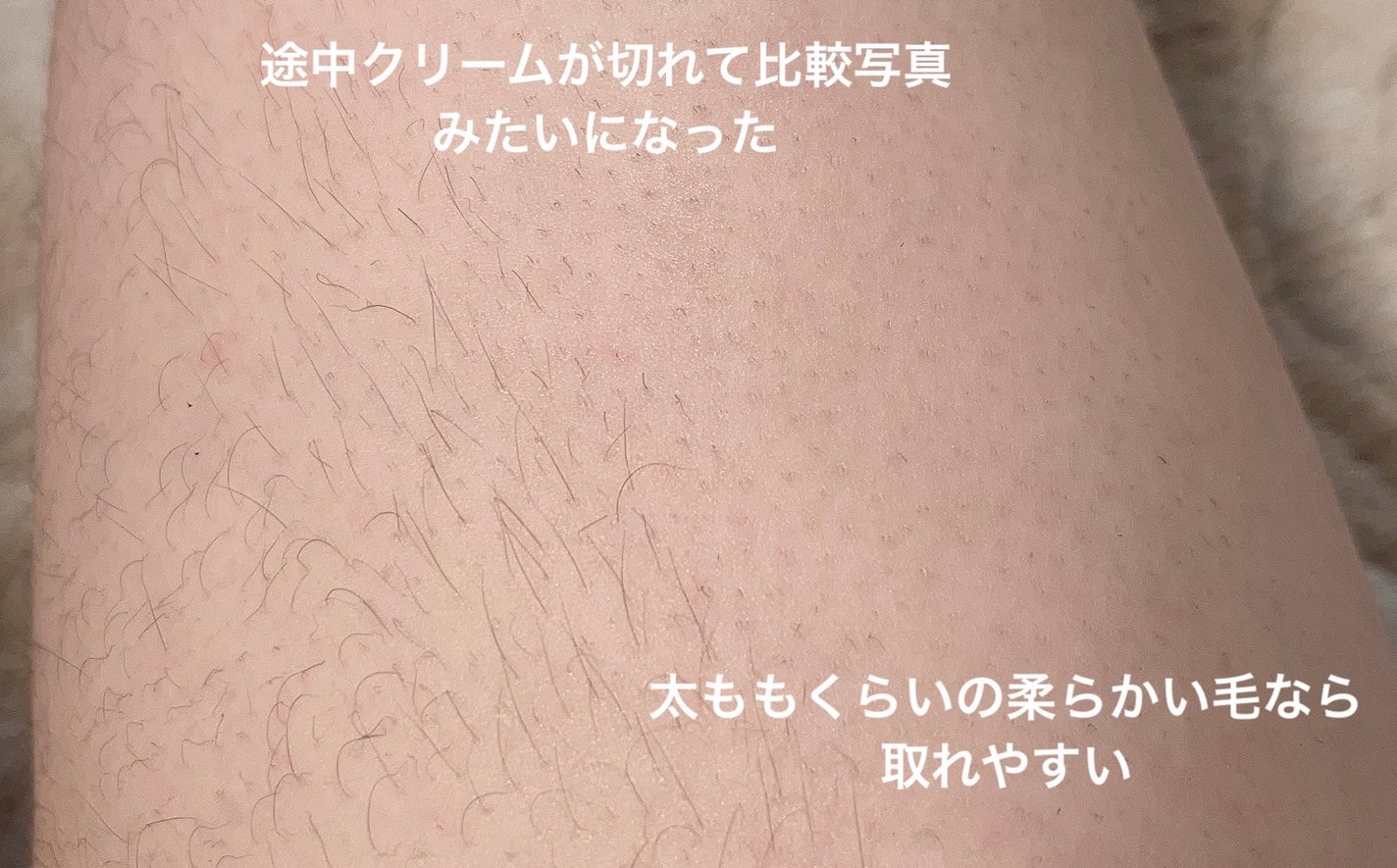 除毛クリーム 敏感肌用/エピラット/除毛クリームを使ったクチコミ(8枚目)