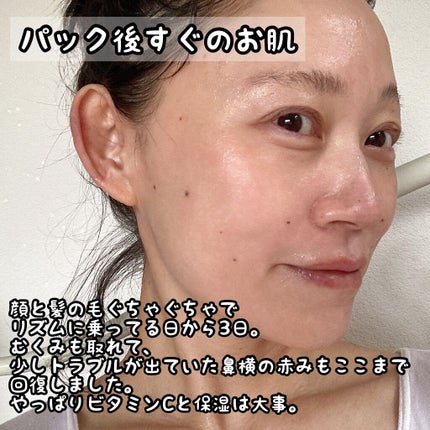 カプセル100 バイオセカンダーム クリア アルファ/MEDIHEAL/シートマスク・パックを使ったクチコミ(7枚目)