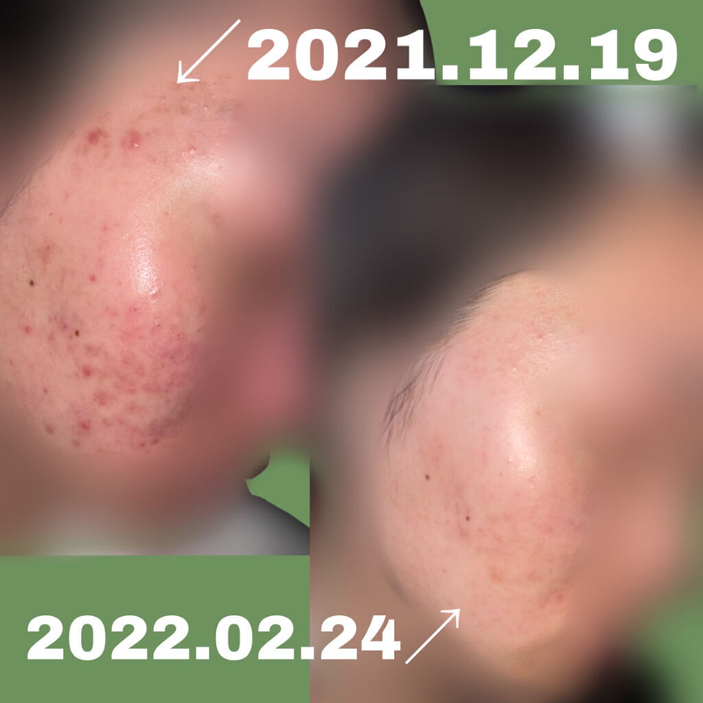 を使ったクチコミ（2枚目）