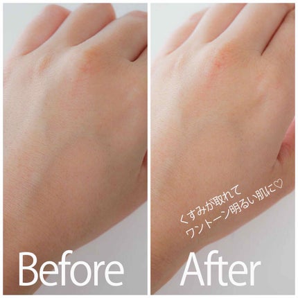 ナチュラルクッションピーリング/アカラン/ピーリングを使ったクチコミ(4枚目)