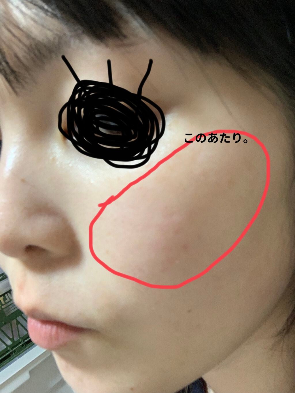 ケシミンクリームEX/ケシミン/フェイスクリームを使ったクチコミ(1枚目)