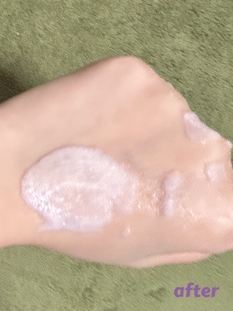 ペプチド ボリューム マスター エッセンス/DR.PEPTI/美容液を使ったクチコミ（3枚目）