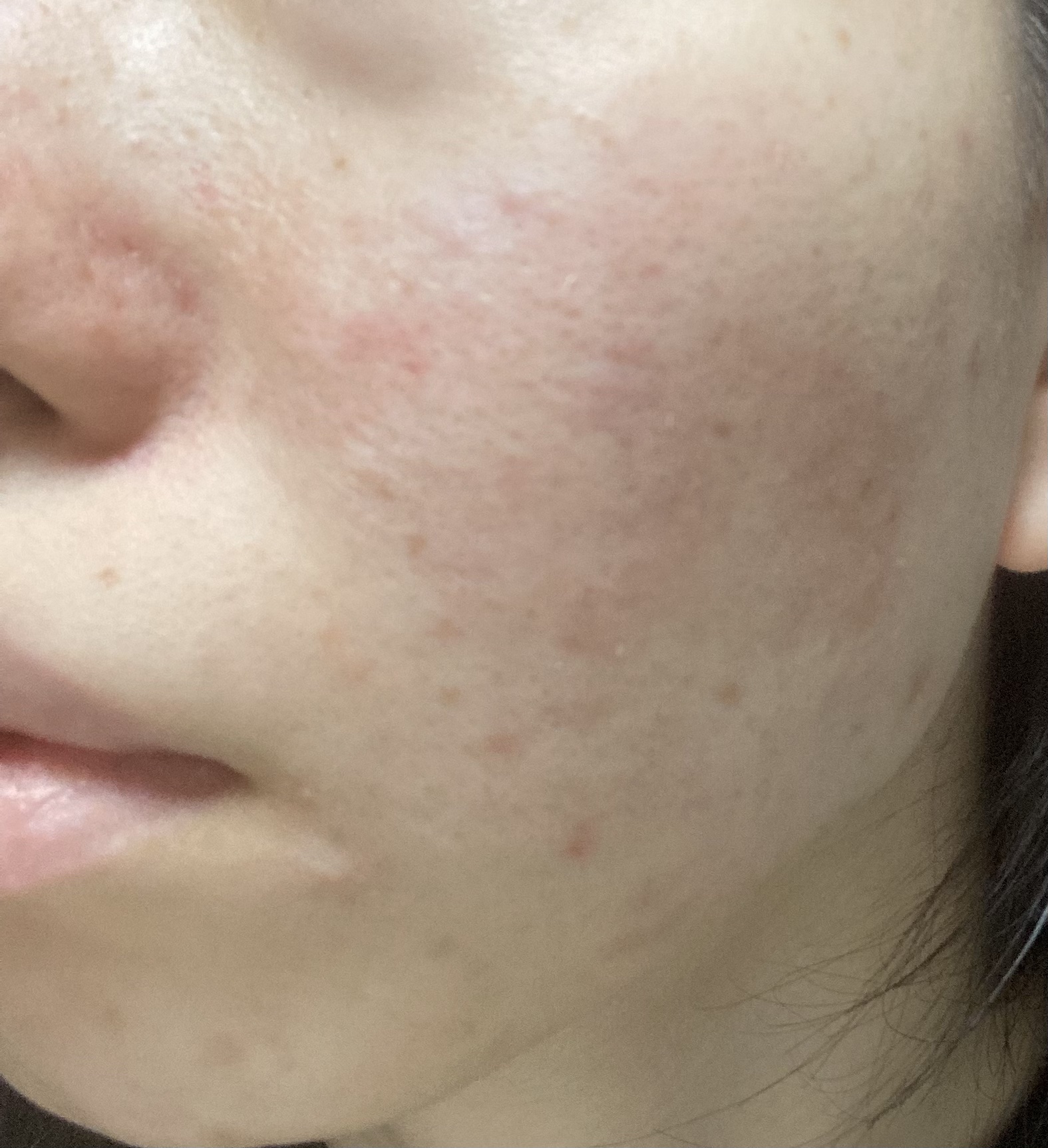 薬用ホワイトニングローションα EX/TOUT VERT/化粧水を使ったクチコミ（1枚目）