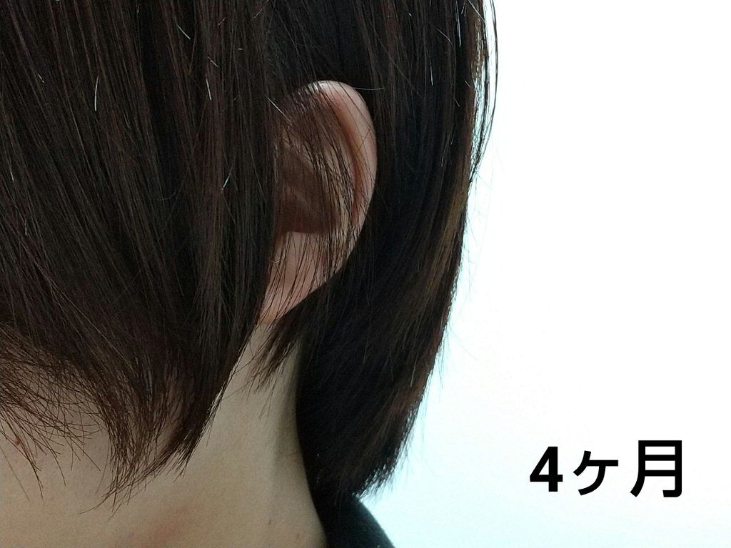 ヘアアクセルレーター フローラルの香り/加美乃素本舗/頭皮ローションを使ったクチコミ（3枚目）