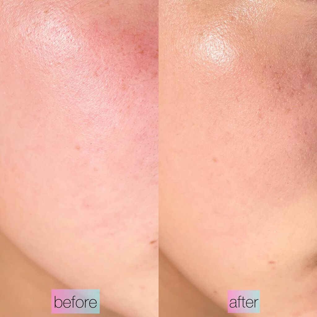 ピンクティーツリーカバークッション/APLIN/クッションファンデーションを使ったクチコミ（3枚目）