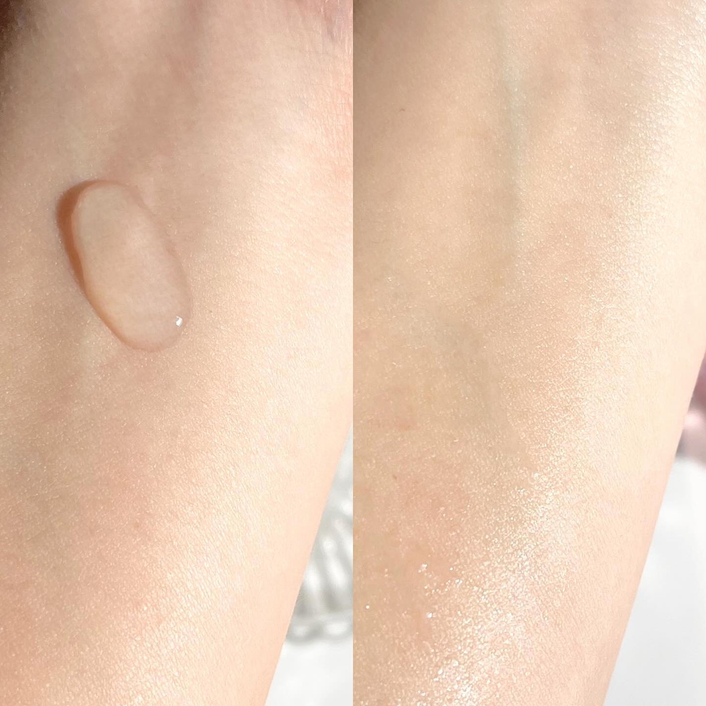 ピンクティーツリートナー/APLIN/化粧水を使ったクチコミ(3枚目)