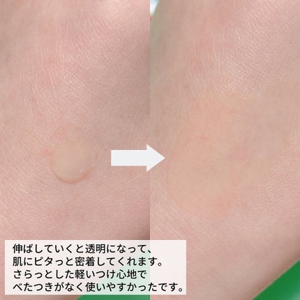 ニキビあとケアジェル/アットノン/その他スキンケアを使ったクチコミ(4枚目)