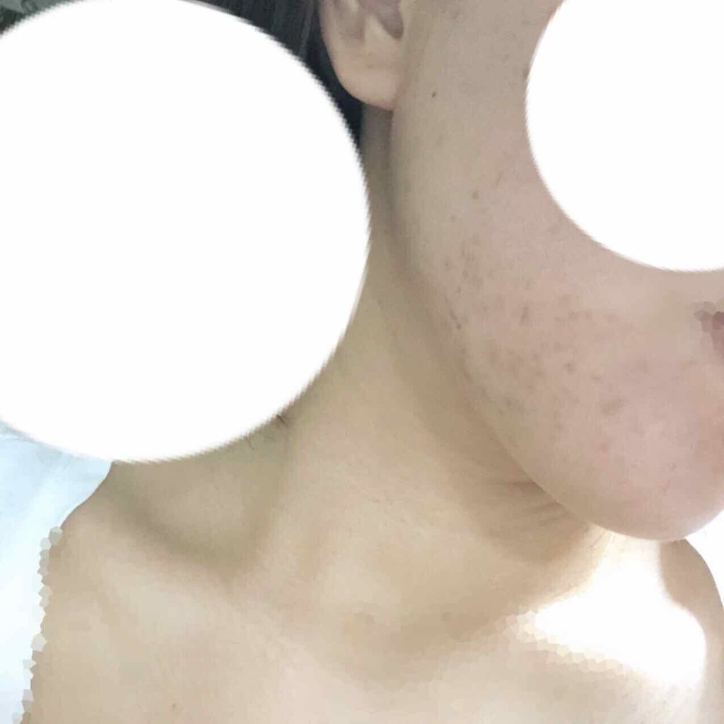 kana on LIPS ãðãããã¬ãðãä¹
ãã¶ãã§ããç¹ã«å€ããã¯ãªãã§ããã8æ4æ¥..ãïŒ3æç®ïŒ