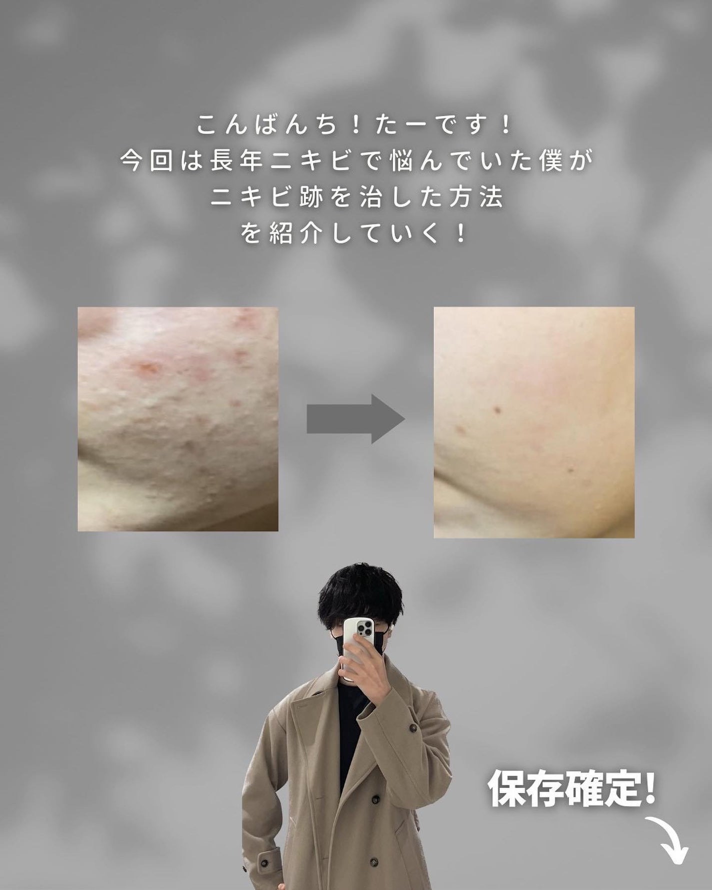 たー on LIPS 「他の投稿こちら💁♂️@mens_makeup1思春期の時にニ..」(2枚目)