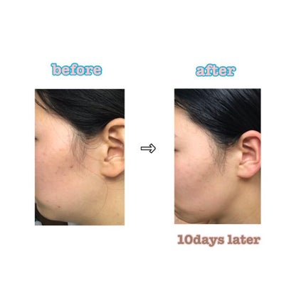 デュオ ザ 薬用クレンジングバーム バリア【医薬部外品】/DUO/クレンジングバームを使ったクチコミ(3枚目)