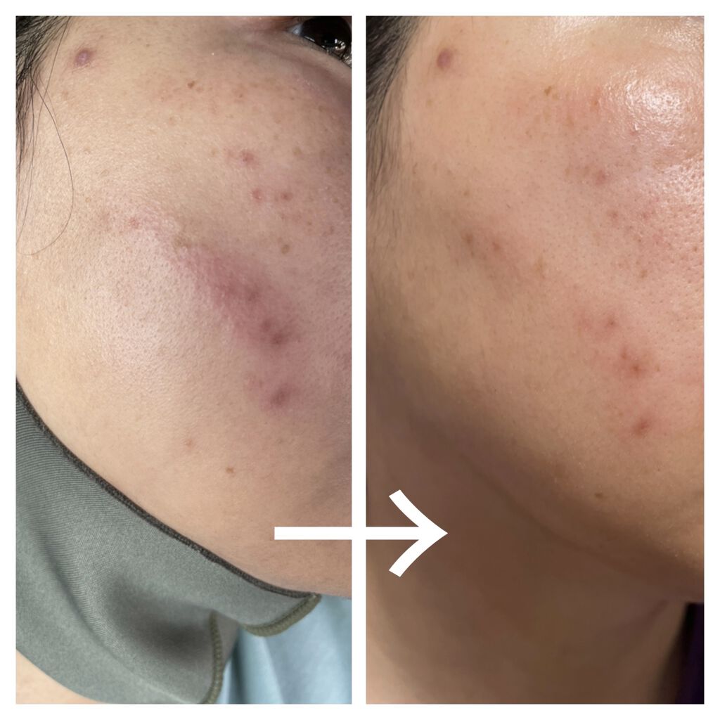 シミシェルジュ/リュバンブラン/フェイスクリームを使ったクチコミ（2枚目）