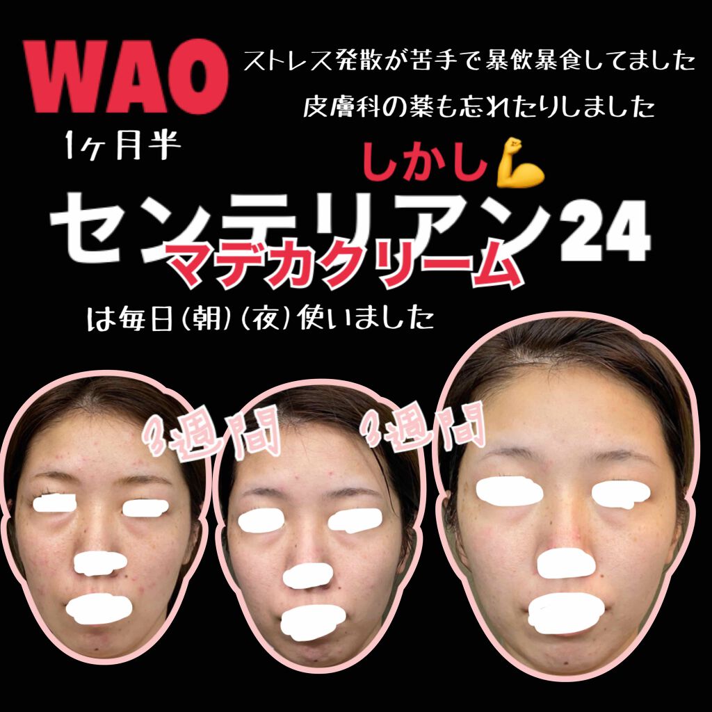 マデカクリーム/センテリアン24/フェイスクリームを使ったクチコミ(1枚目)
