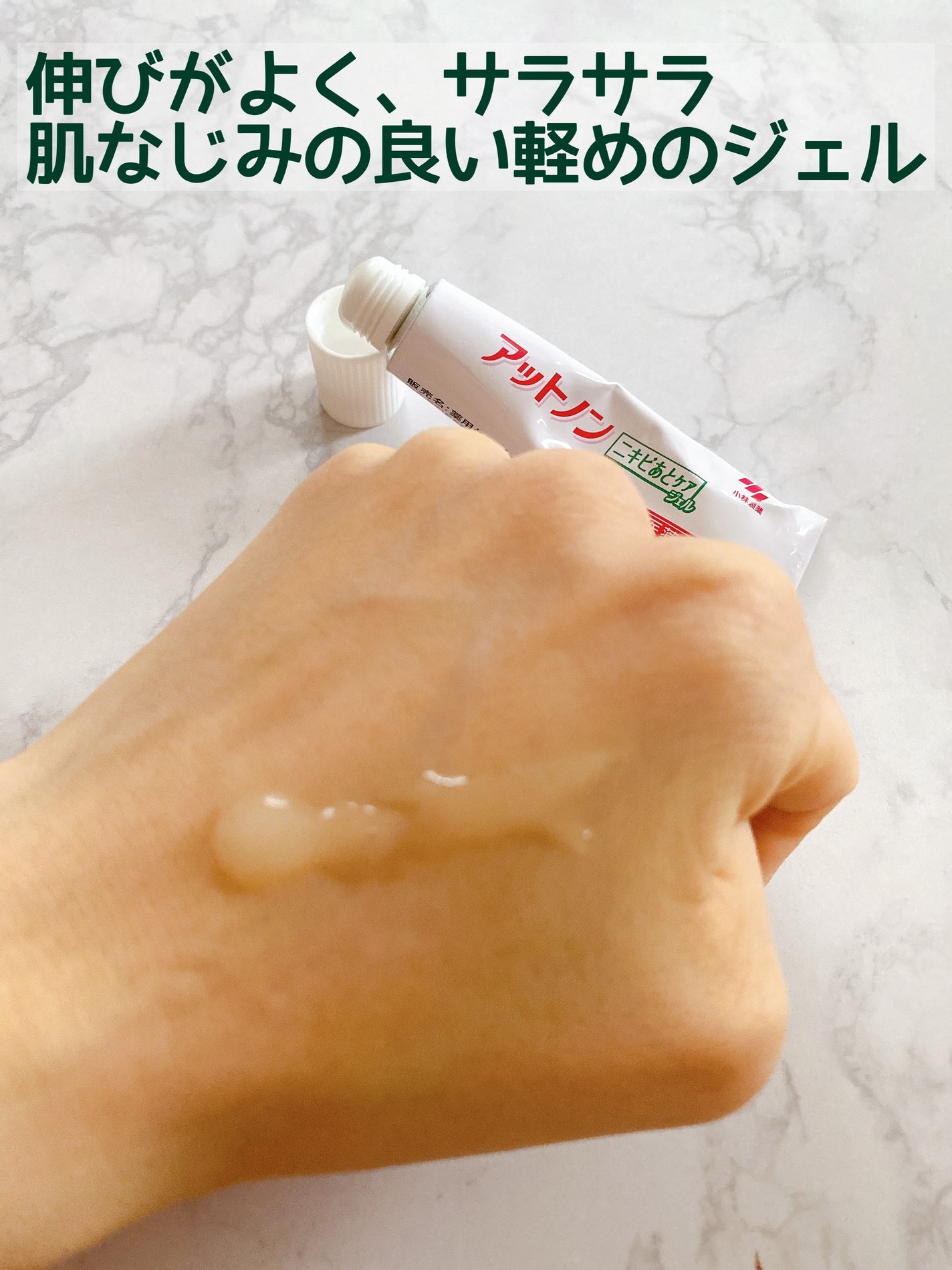 ニキビあとケアジェル/アットノン/その他スキンケアを使ったクチコミ(3枚目)