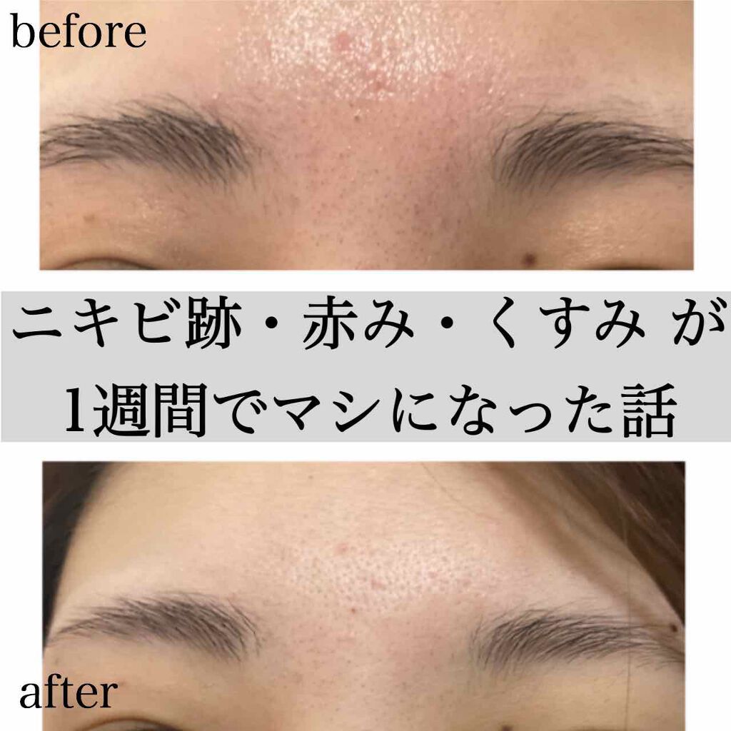 ロゼット洗顔パスタ 海泥スムース/ロゼット/洗顔フォームを使ったクチコミ(1枚目)