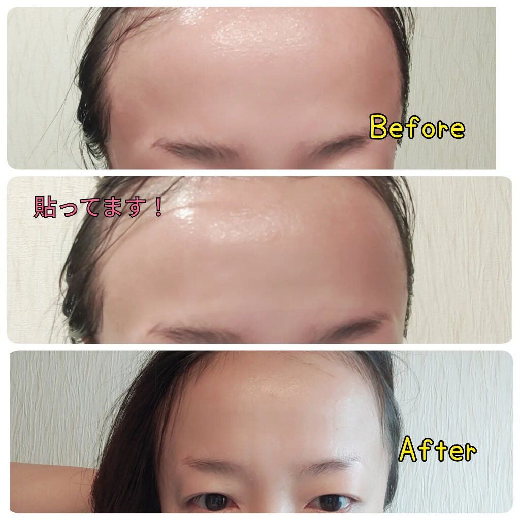 オデコディープパッチ/北の快適工房/シートマスク・パックを使ったクチコミ(2枚目)