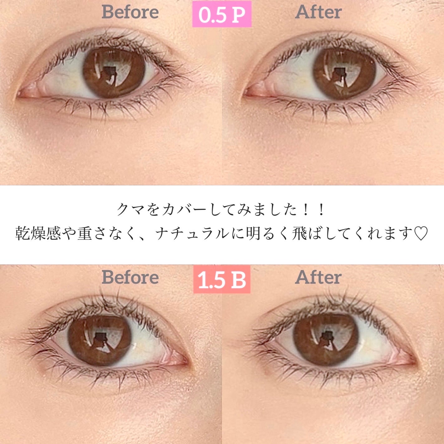 ダーマシンコンシーラー/23years old/リキッドコンシーラーを使ったクチコミ(5枚目)