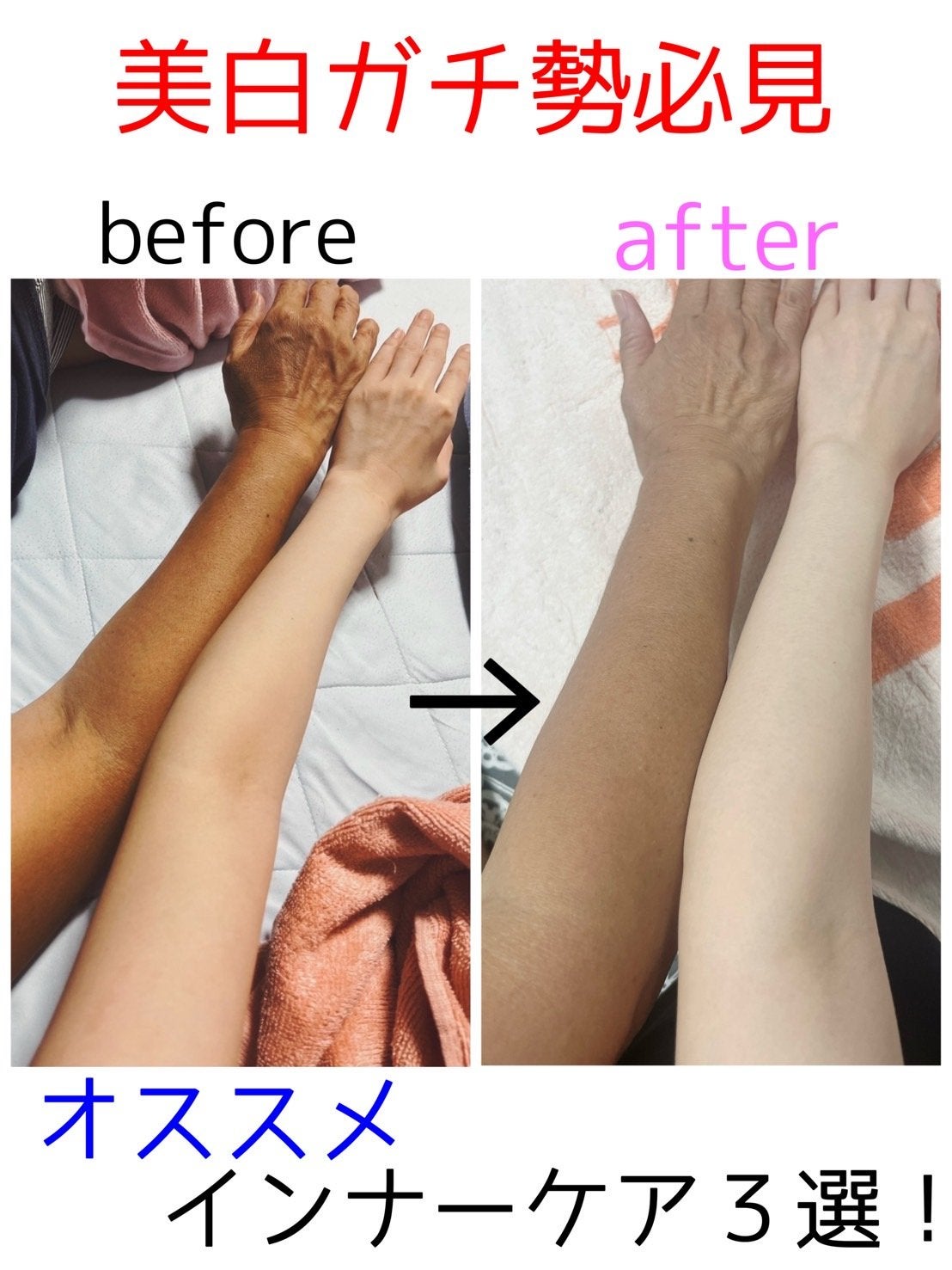 スノーセル/メディタミン/美容サプリメントを使ったクチコミ(1枚目)