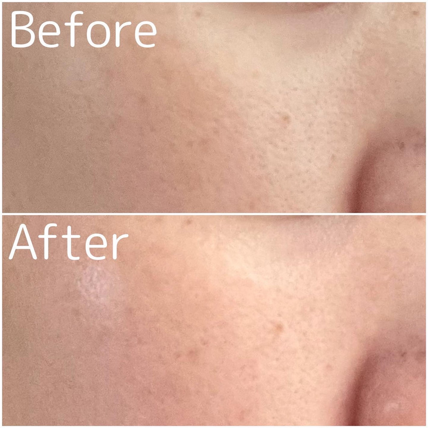 ベネフィーク セラム/BENEFIQUE/美容液を使ったクチコミ(3枚目)