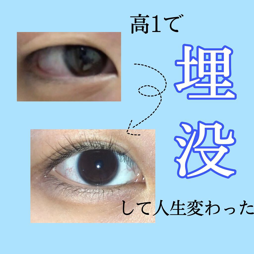 アイビューティー フィクサー WP/アストレア ヴィルゴ/二重まぶた用アイテムを使ったクチコミ（1枚目）