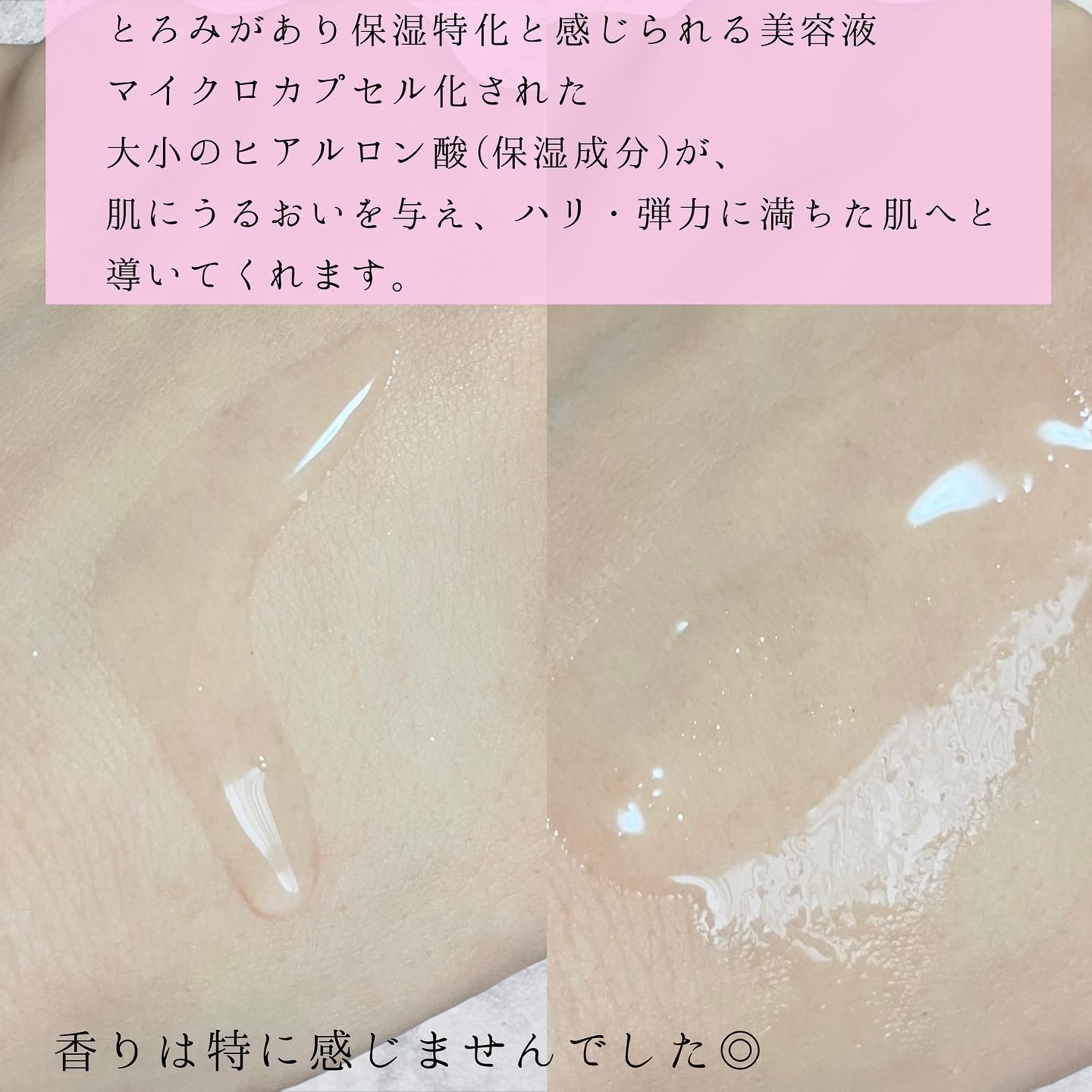 テラスキン/LINE REPAIR/美容液を使ったクチコミ（3枚目）