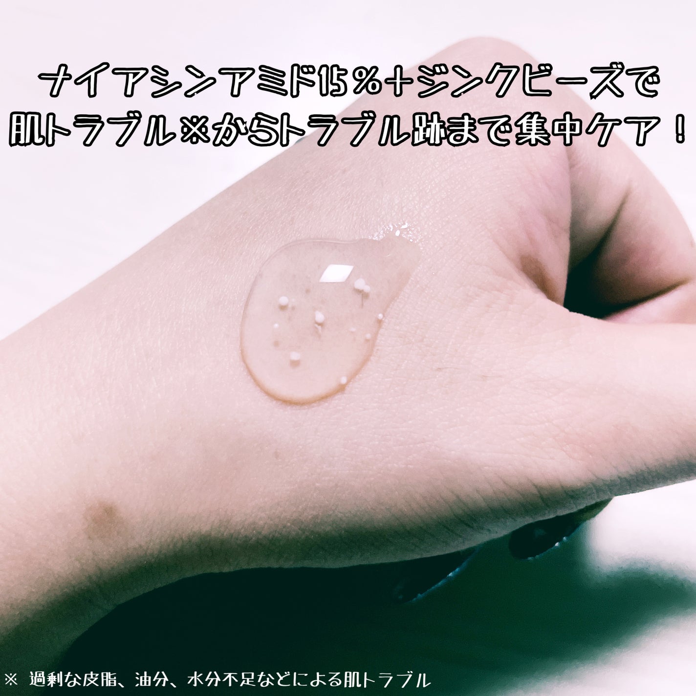 ナイアシンジンクビーズセラム/Frankly/美容液を使ったクチコミ(3枚目)