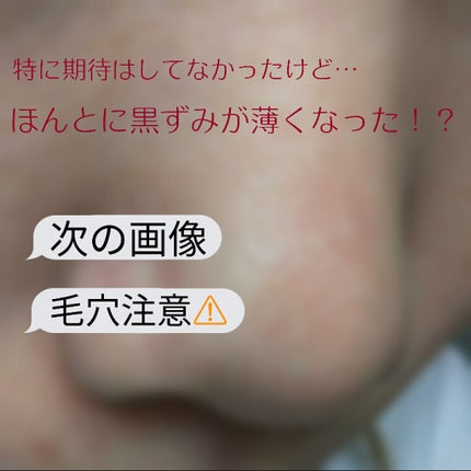 オーガニック炭酸ホワイトパック/Sing/洗い流すパック・マスクを使ったクチコミ(1枚目)