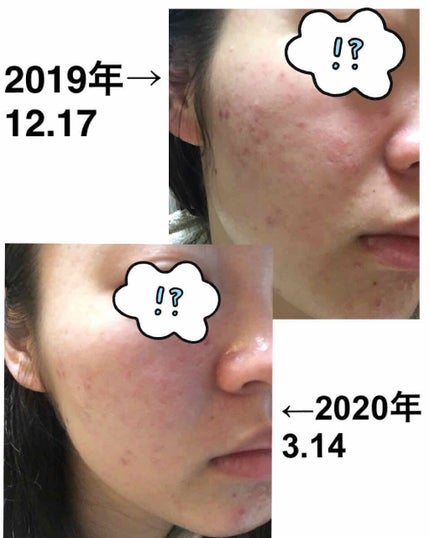 ハトムギ化粧水(ナチュリエ スキンコンディショナー R )/ナチュリエ/化粧水を使ったクチコミ(3枚目)
