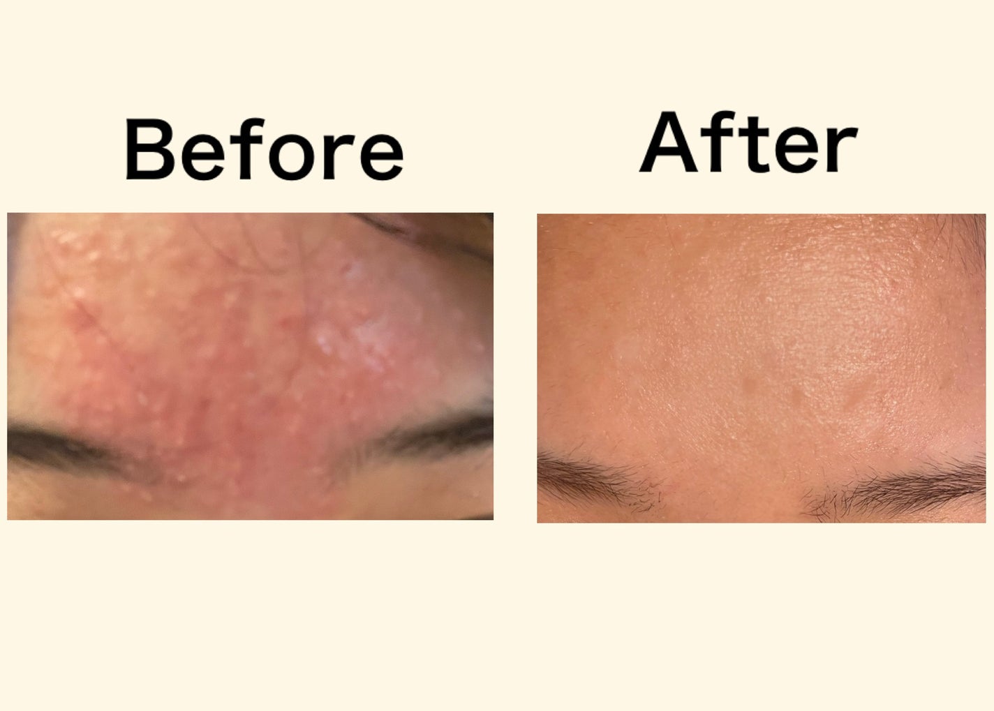 極潤ヒアルロン乳液/肌ラボ/乳液を使ったクチコミ(3枚目)