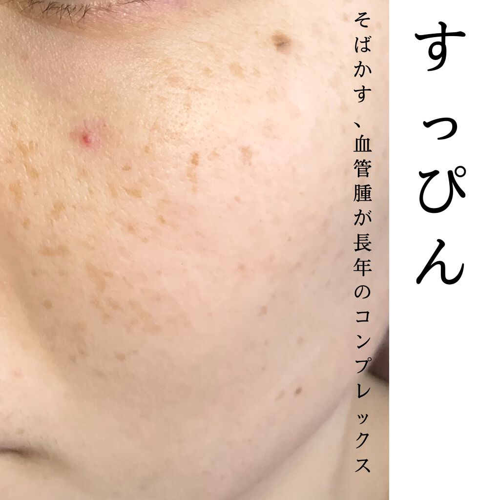 フローレス フィット/COVERMARK/クリーム・エマルジョンファンデーションを使ったクチコミ（2枚目）