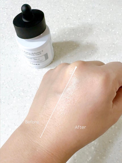 RXザ・アルファアルブチン2 ニキビ跡ケアセラム/COSRX/美容液を使ったクチコミ(4枚目)