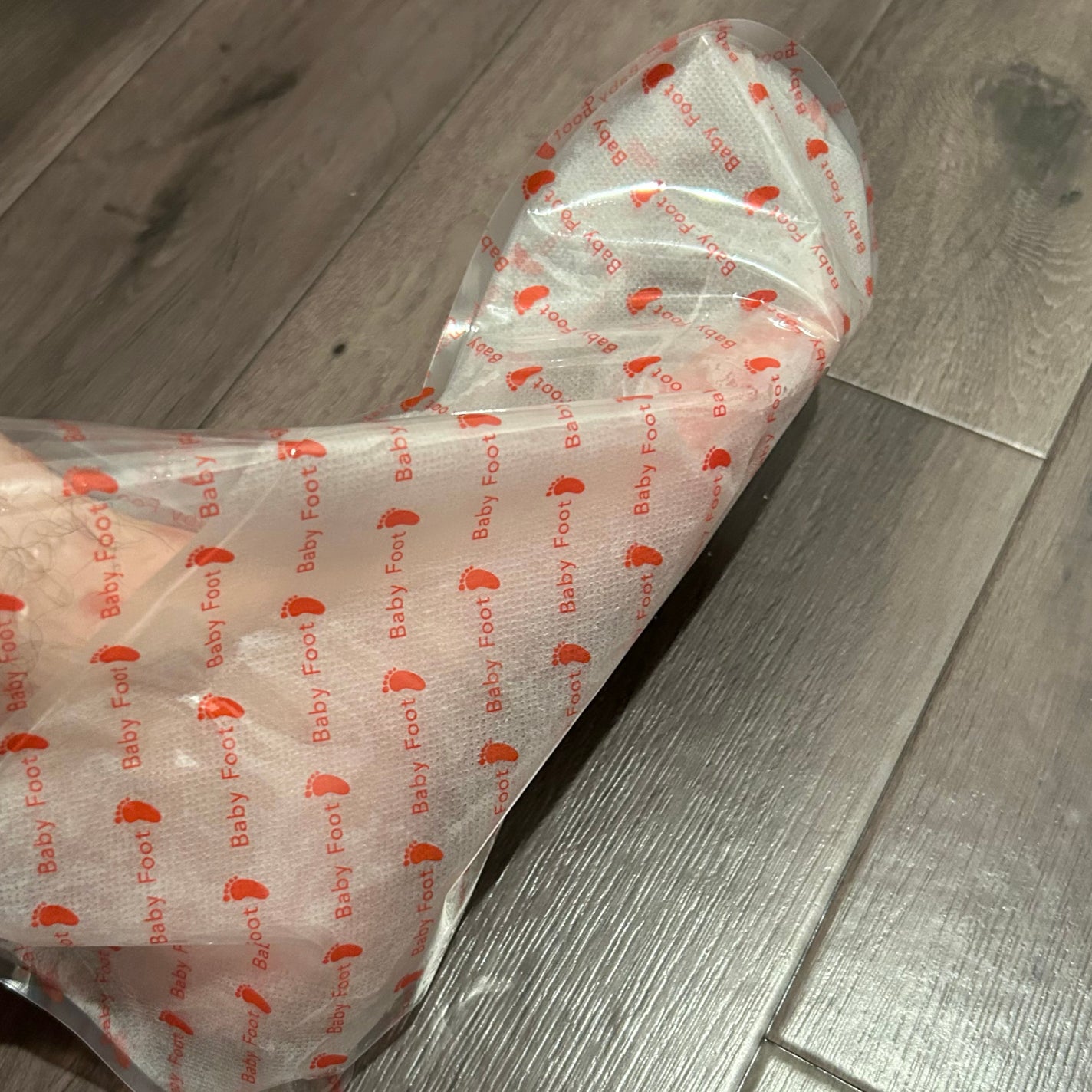 ベビーフット 重曹殺菌消毒洗浄剤/ベビーフット/レッグ・フットケアを使ったクチコミ(3枚目)