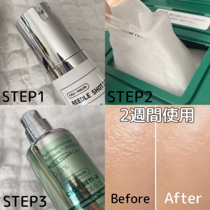 CICA デイリースージングマスク/VT/シートマスク・パックを使ったクチコミ(5枚目)