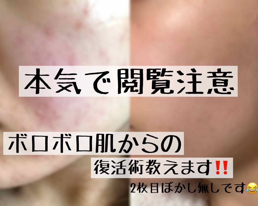 カレンドラ ケアクリーム/WELEDA/ボディクリームを使ったクチコミ(1枚目)