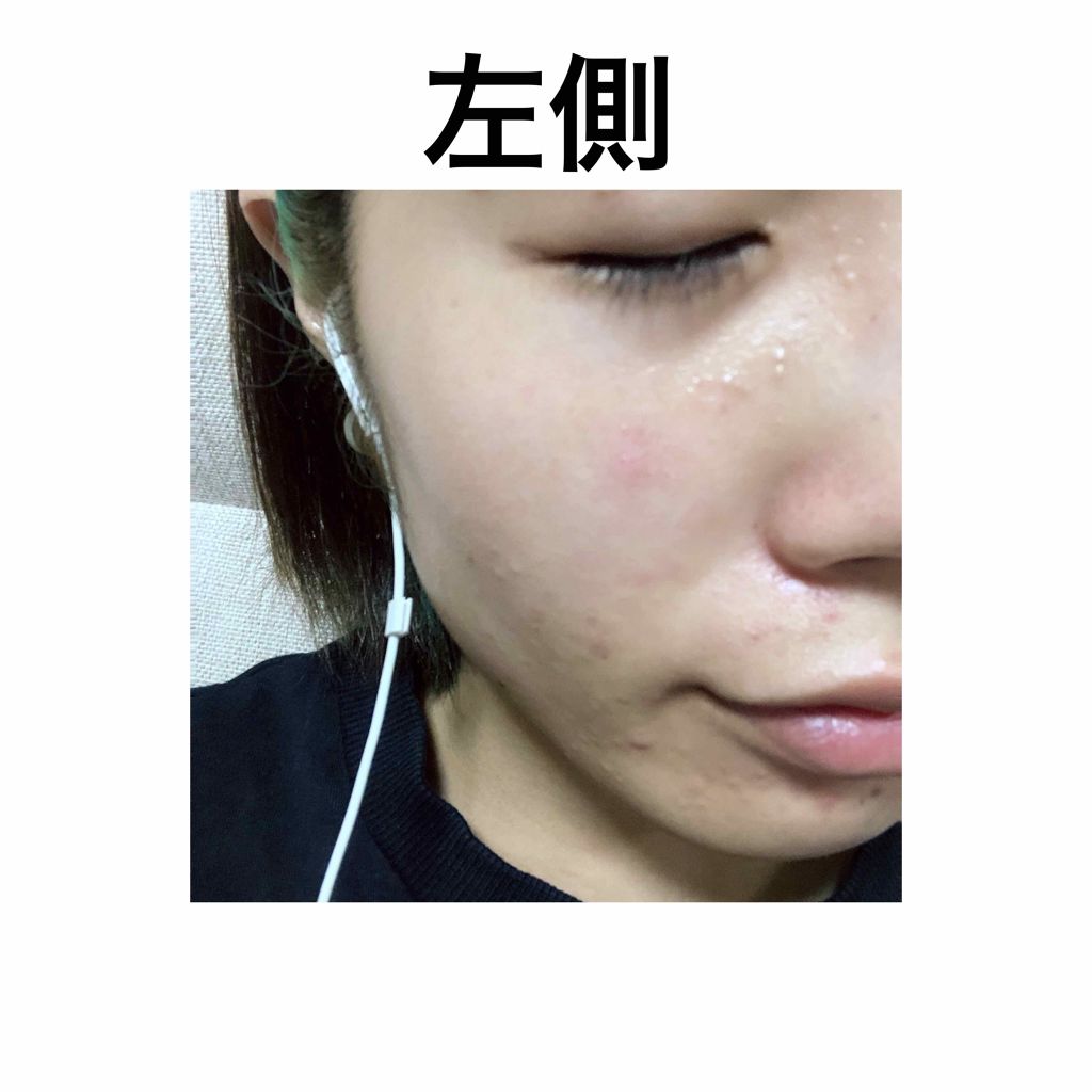 薬用 クリアローション M(しっとりタイプ)/オルビス/化粧水を使ったクチコミ（3枚目）