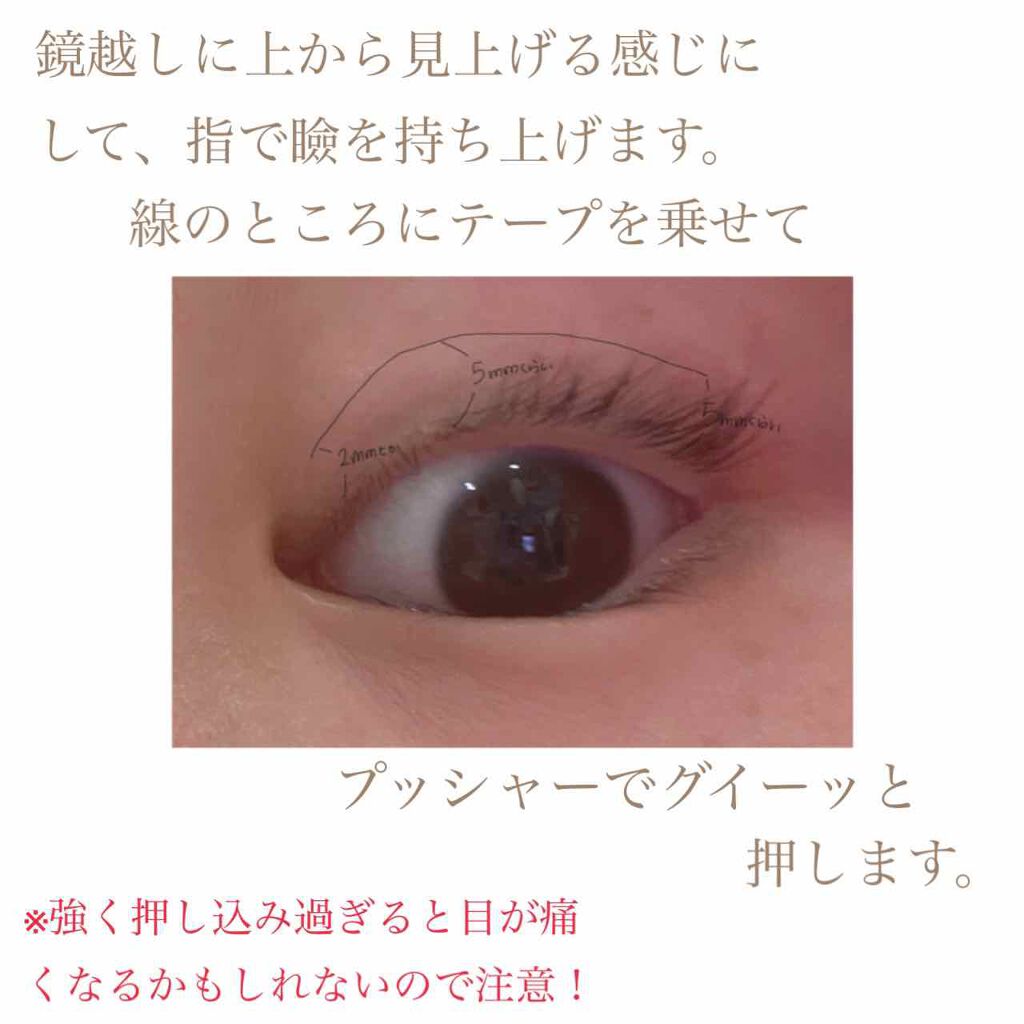 ワンダーアイリッドテープ Extra/D-UP/二重まぶた用アイテムを使ったクチコミ（3枚目）