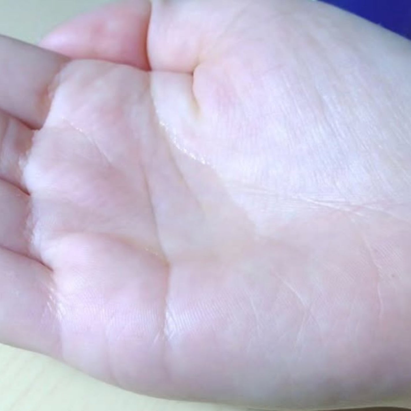 タカミスキンピール/タカミ/ブースター・導入液を使ったクチコミ(3枚目)