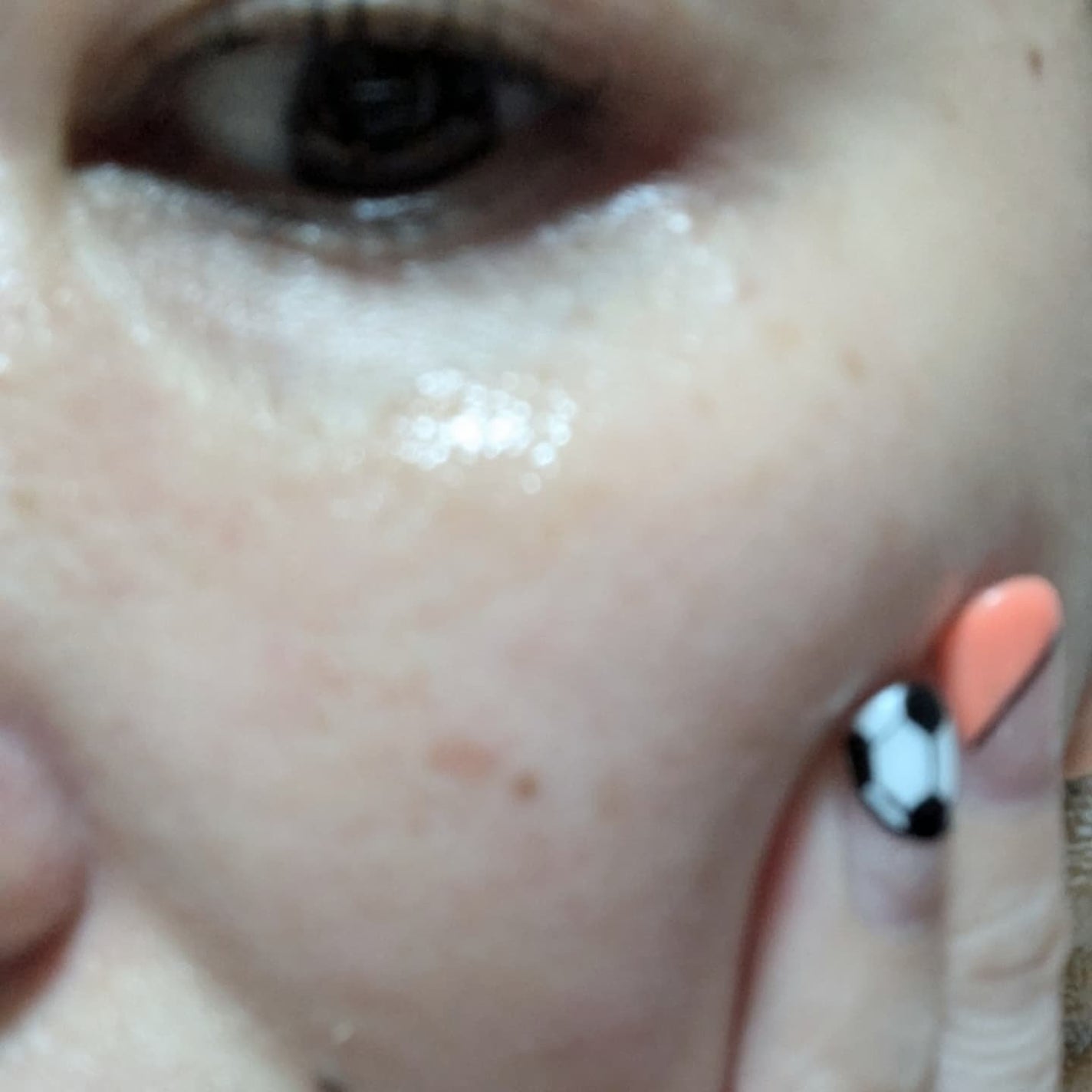 ビディ ニードルエッセンス NN/ビディ/美容液を使ったクチコミ(5枚目)