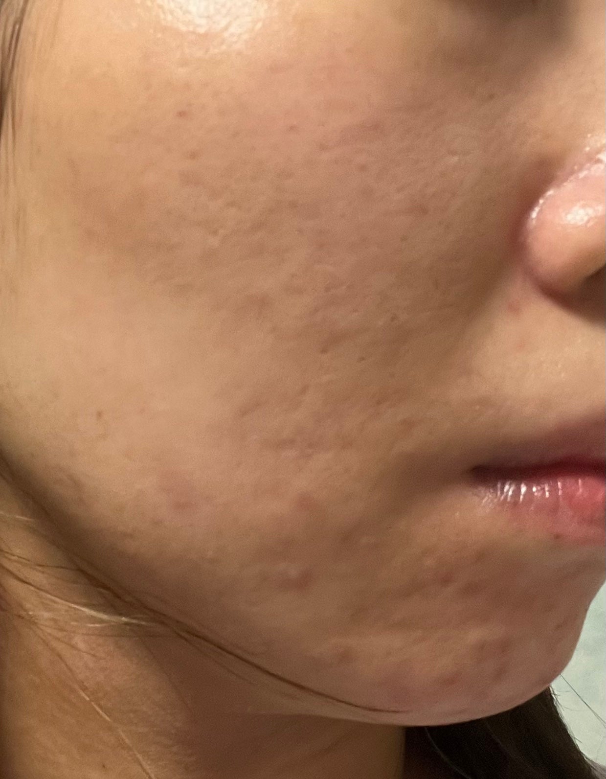 こぐまちゃん on LIPS 「今日で(日付変わっちゃったけど)塗り始めて2週間経過5日くらい..」(2枚目)