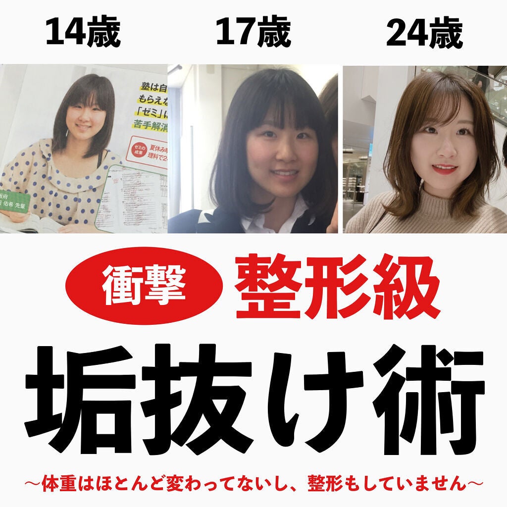 デンタルブラシ/DHC/歯ブラシを使ったクチコミ(1枚目)