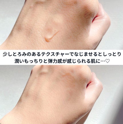 オイデルミン エッセンスローション/SHISEIDO/化粧水を使ったクチコミ(2枚目)