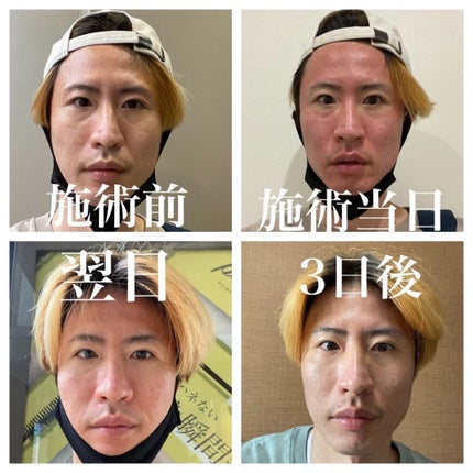 を使ったクチコミ(2枚目)